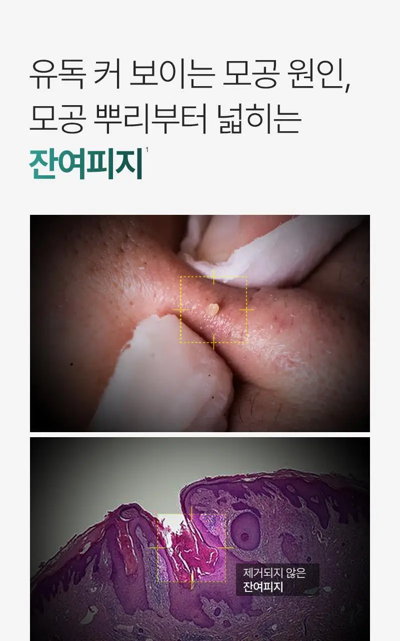 [4중 모공 개선/병풀추출물 7,793ppm] 피캄 포시카 앰플 30ml 상세페이지 4